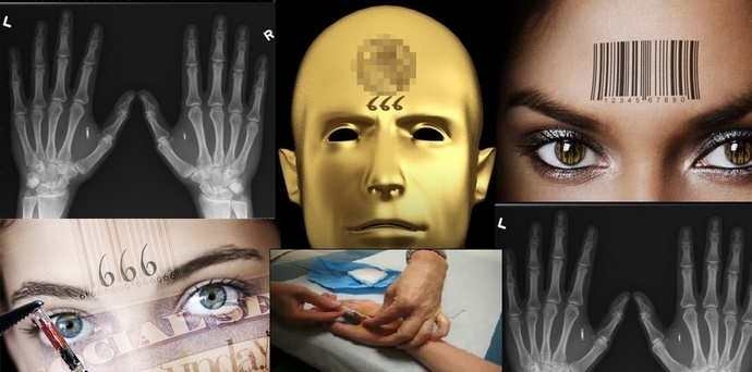 Cipul implant wireless, cât un fir de sare, a fost creat în Coreea de Sud