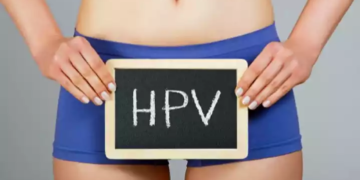 Totul despre virusul papiloma uman HPV