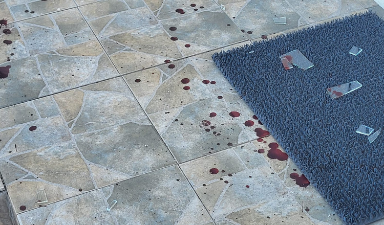 Un hoț din Dâmbovița a sunat singur la 112 după ce s-a accidentat grav în timpul jafului