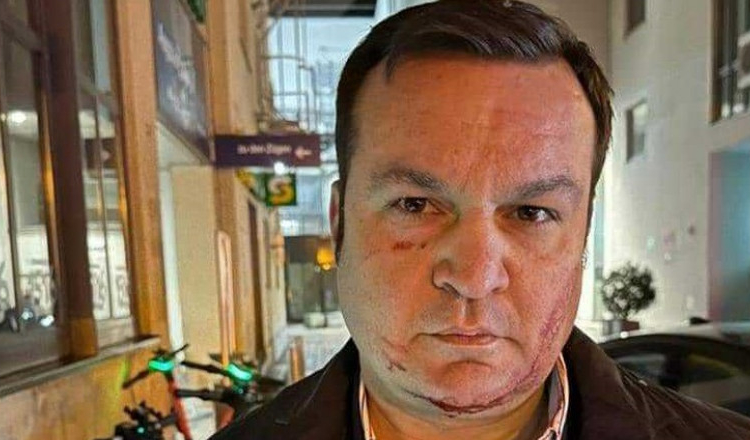 Predoiu spune că Cherecheş s-a rănit la faţă când încercat să scape: Practic o lovire în timpul fugii, nu neapărat de către poliţişti