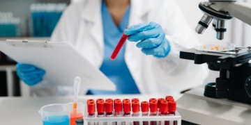 Un nou test de sânge revoluționar care detectează cancerul în stadii incipiente a fost validat cu succes în studiile clinice