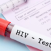 Testul HIV